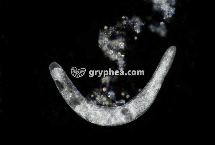 Protozoaire indeterminé x40 - gryphea.com